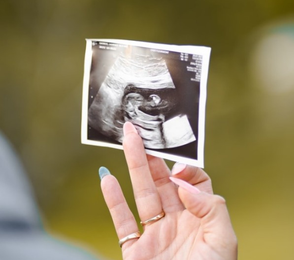 임신(pregnant)에 관한 모든 것;임신초기,아기집,태낭,임신안정기,아기심장소리,태아성별,임신9개월,출산9개월차,생후9개월,임신하는팁,임신가능성,임신꿈,아기꿈해몽,아기와노인.