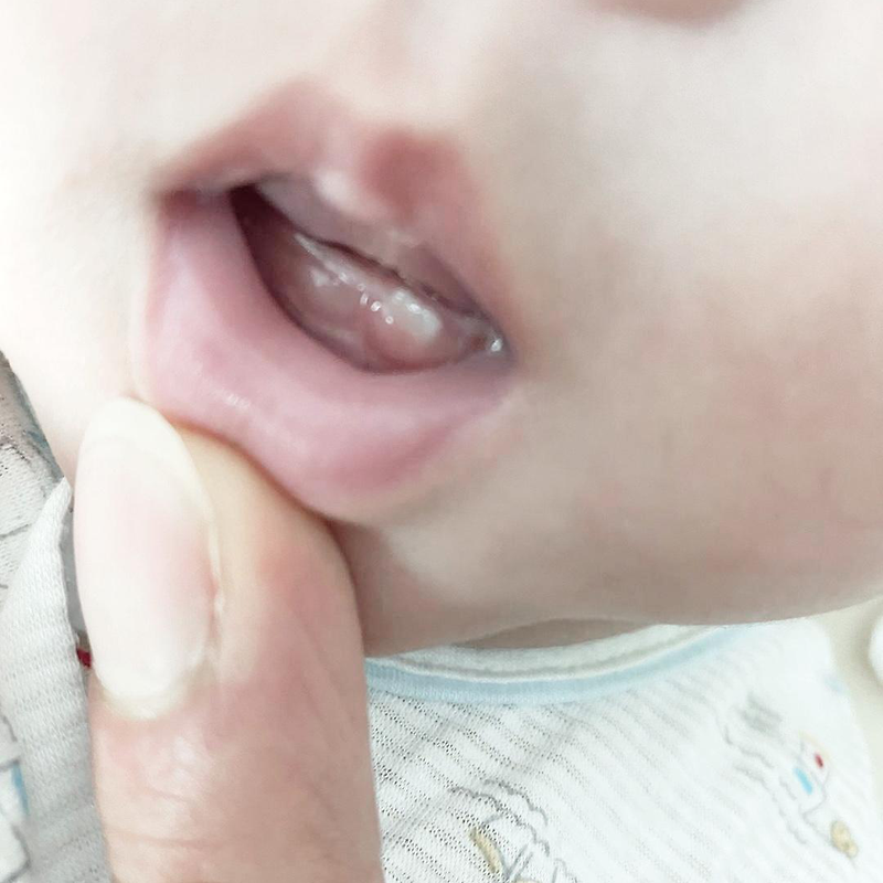 [아기첫니] 신생아부터 첫니 잇몸관리,치아관리