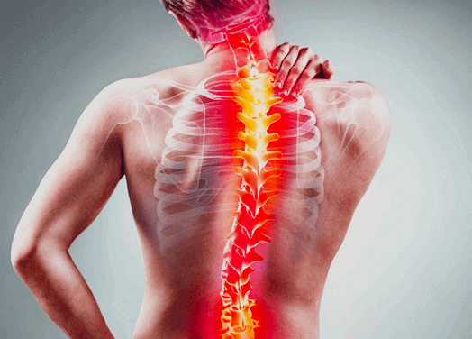 척추측만증 증상 및 예방법 : 특발성, 테스트