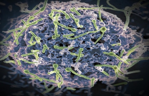 에볼라 바이러스 아프리카 기니 비상입니다.