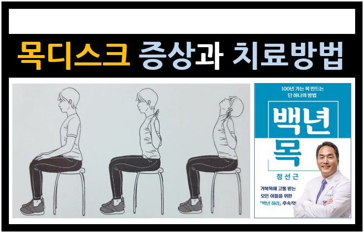 목디스크 증상과 치료방법 / 거북목 예방