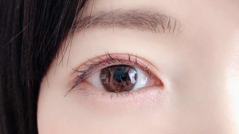 눈 다래끼 빨리낫는 법 그리고 원인과 증상 찜질+항생제 이간혈?