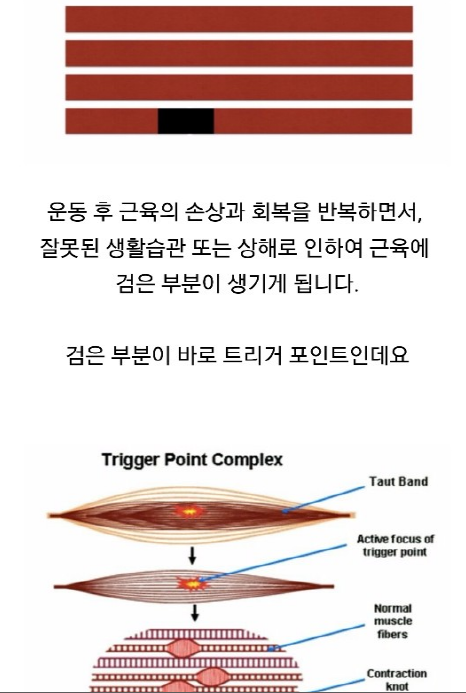 트리거 포인트란?