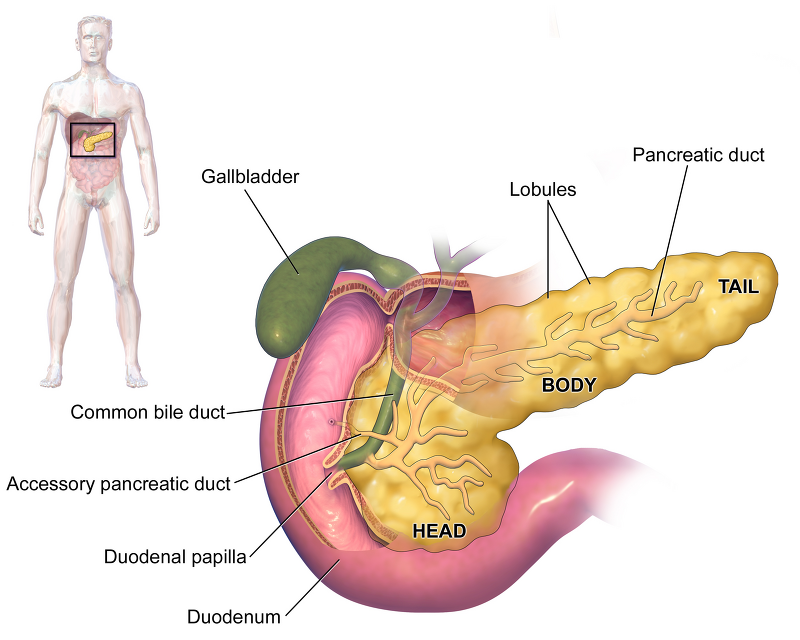 췌장과 잘 걸리는 4가지 췌장암의 원인으로 본 20대 췌장암