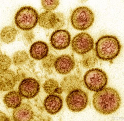 이번엔 한타 바이러스에 대비하라 !  중국, 한타 바이러스 감염자 사망 !