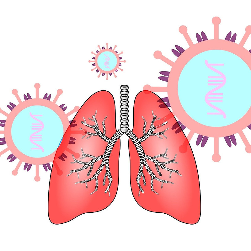 폐렴 초기증상과 원인