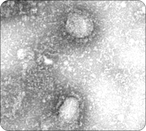 신규 코로나 바이러스 감염증 증상과 예방