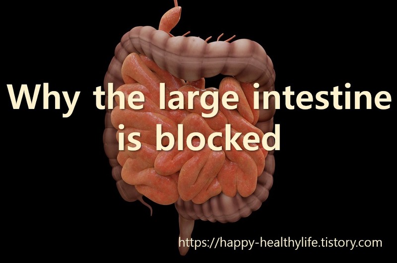 Why the large intestine is swollen and why the large intestine is blocked