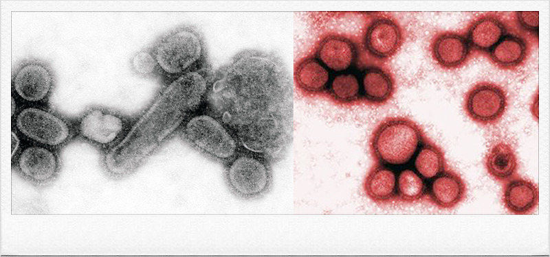 바이러스. 역사상 가장 치명적인 전염병