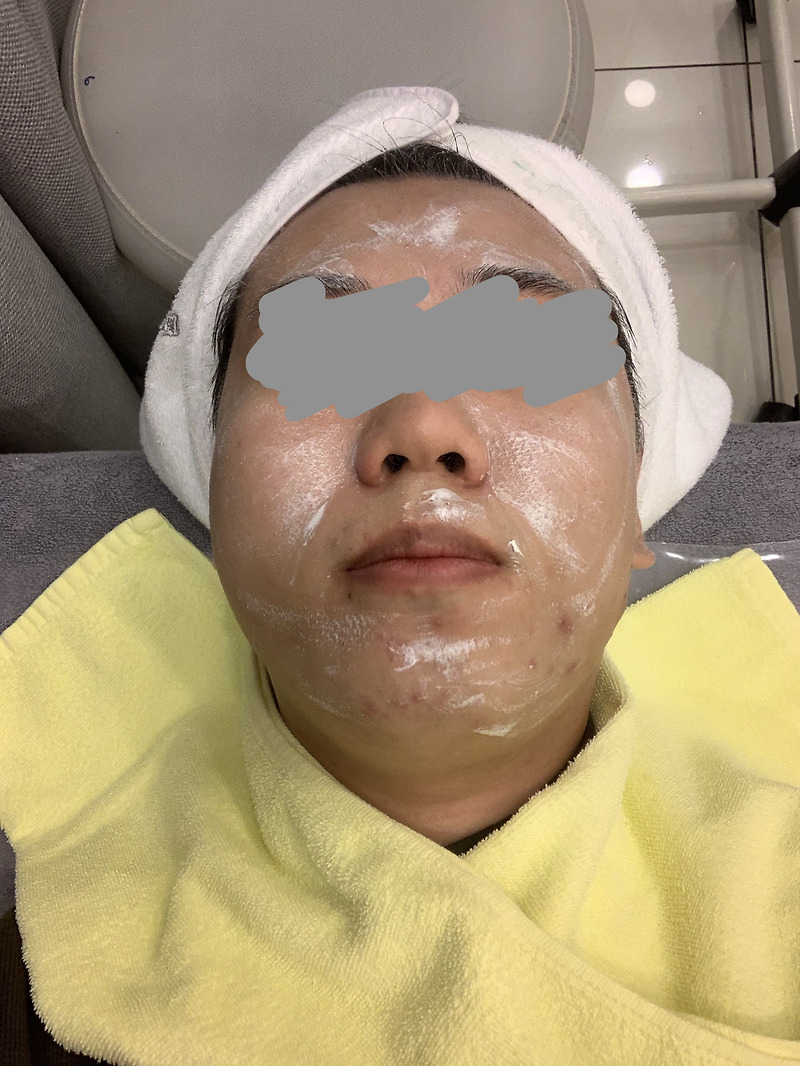 강남 신논현역 미파문 피부과 - 성인 여드름 지루성 피부염 일반진료 및 치료