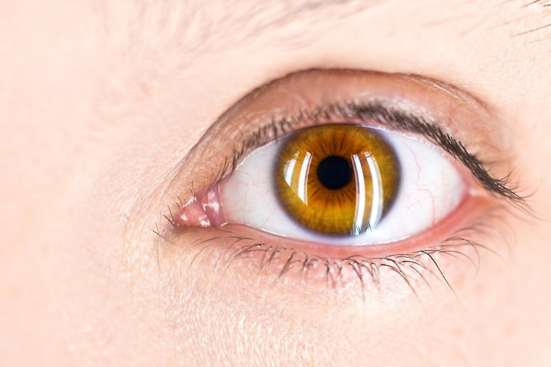 망막 색소 변성증 원인과 치료