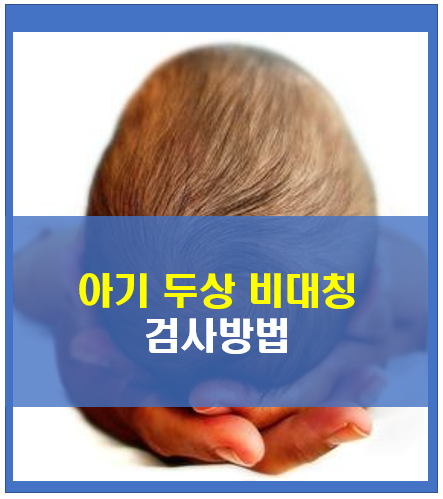 아기 두상 비대칭 집에서 할 수있는 검사방법 - 사두증/단두증