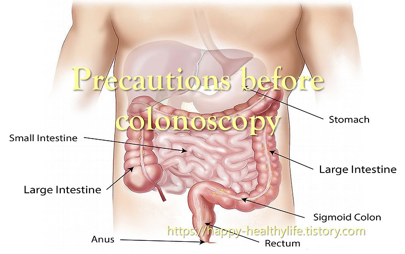 Precautions before colonoscopy and how to take colonoscopy