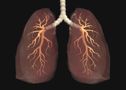 건선치료 방법의 핵심은 폐의 건강?