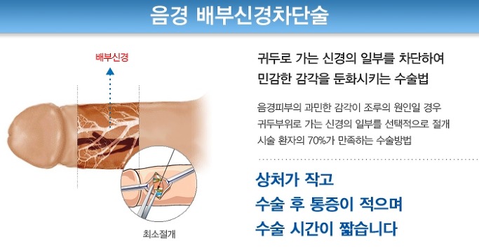 신경차단수술후 관리