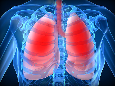 기침과 가래, 흉통을 동반하는 폐렴 증상