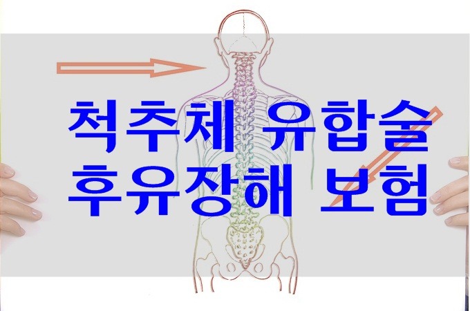 척추 유합술(고정술) 상해후유장해보험금 판단!