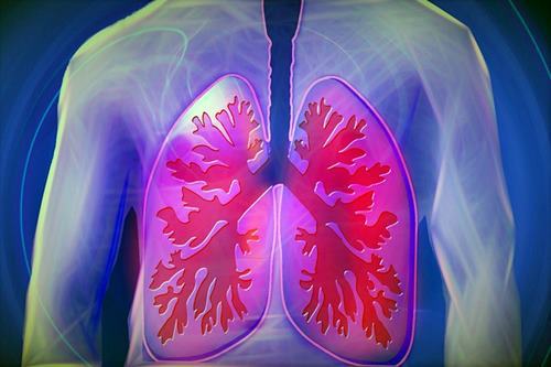 폐암(lung cancer)은 생존율이 가장 낮은 암(cancer)