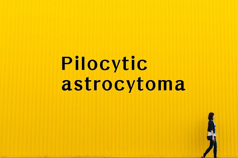 Pilocytic astrocytoma(D43) 털모양별아세포종 고액암,암진단비 보상!?