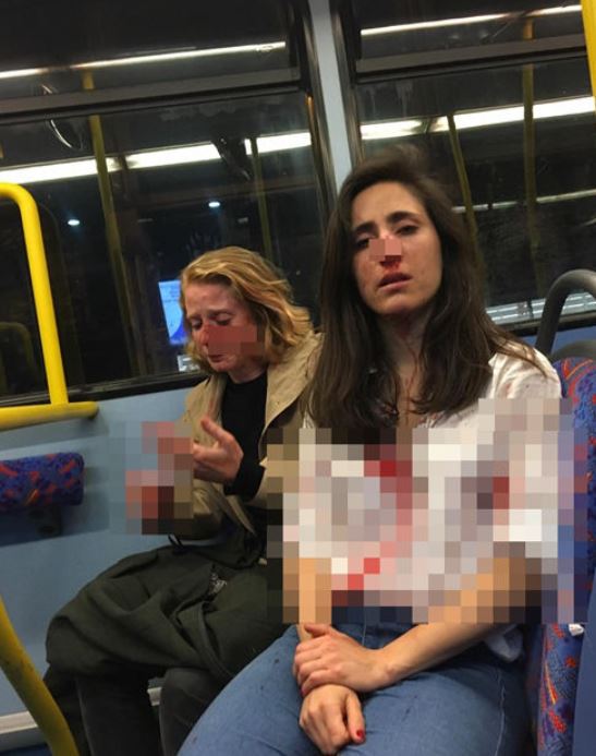 런던 버스 커플 키스요구와 폭행사건