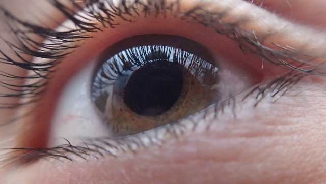 무엇이든물어보세요 녹내장예방법, 노력한만큼 볼수있다 눈건강관리법