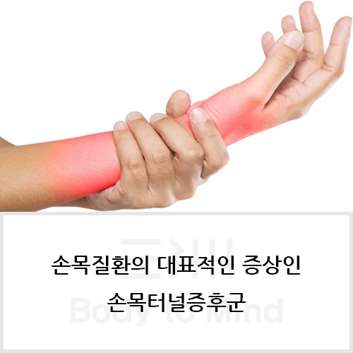손목질환(wrist injury)의 대표적인 증상인 손목터널증후군(carpal tunnel syndrome)