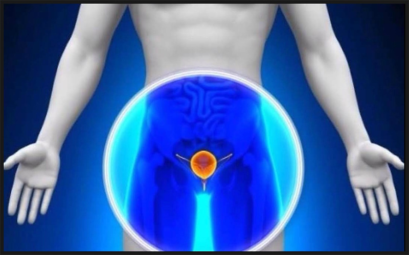 비뇨기과질환 완전 정복 4장- 전립선염의 증상과 치료(Symptoms and Treatment of Prostateitis)
