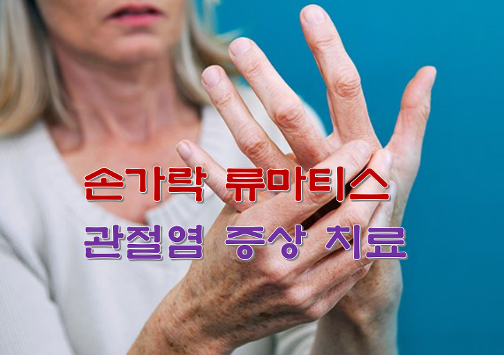 손가락 류마티스 관절염 증상 치료