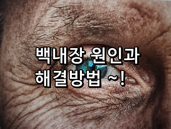 백내장 원인과 백내장 증상 알아봅시다~!