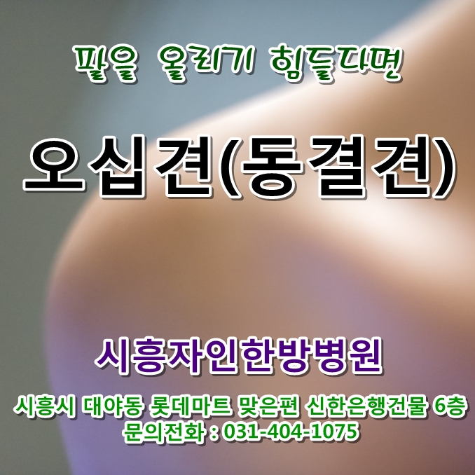 오십견/동결견/유착성관절낭염(Adhesive capsulitis ~처럼