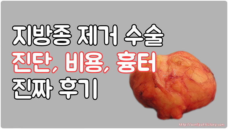 지방종 제거 수술 후기 (feat. 걱정과 두려움 씻어내기)