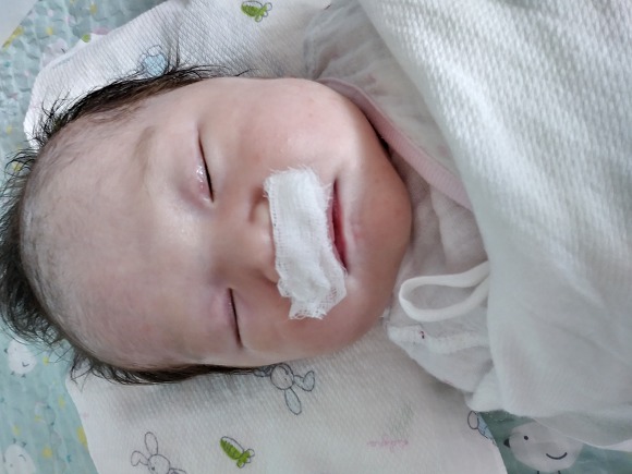 아기(신생아) 코딱지 빼는 방법 크린조 식염수 와 거즈+면봉