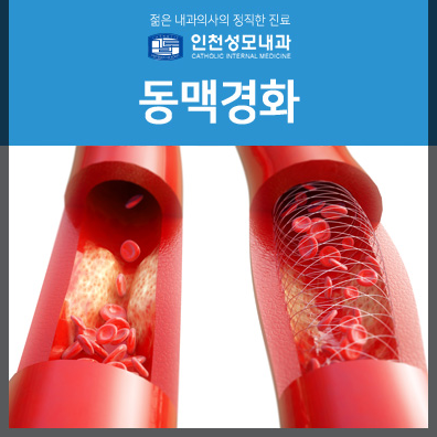 인천동맥경화의 원 봅시다