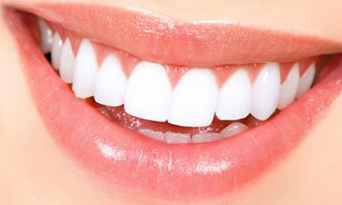 잇몸 관리법 및 치아관리 방법