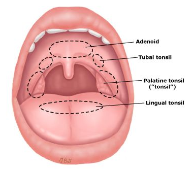 편도염(Tonsillitis),  봅시다