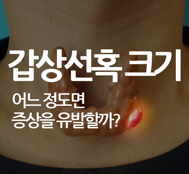 갑상선 혹(결절) 크기가 어느 정도 확인