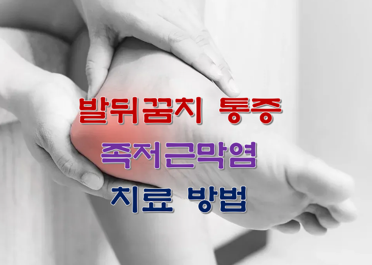 발뒤꿈치 통증 족저근막염 치료 방법