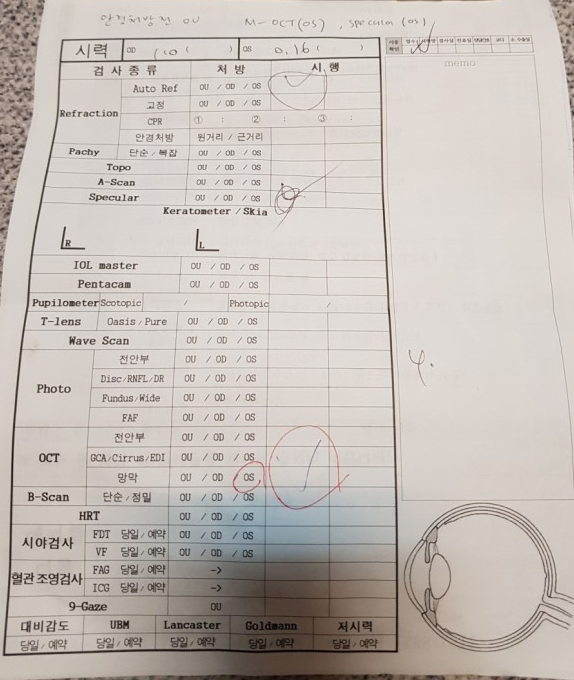 강남성모병원 백내장수술 후 !!