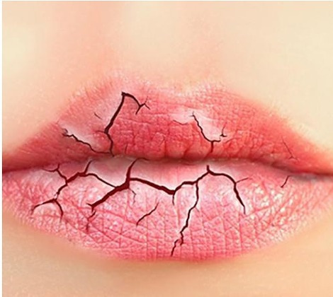 입술건조 예방법 및 관리법