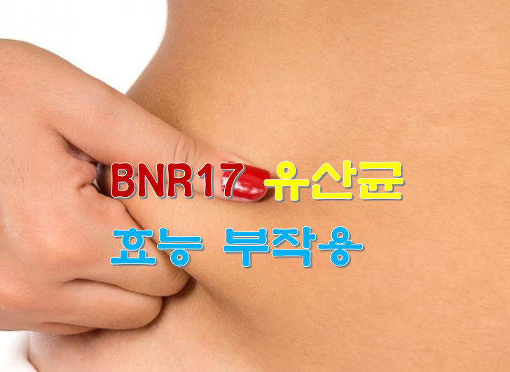 BNR17 유산균 효능 부작용