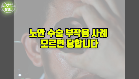 노안 수술 부작용 사례 모르면 당합니다