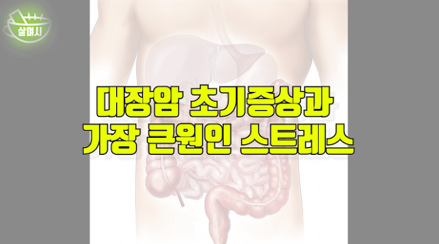 대장암 초기증상과 가장 큰원인 스트레스