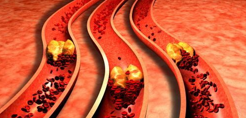 동맥경화 발생과정, 혈관 구조 재현한 '오간온어칩'으로 밝혀