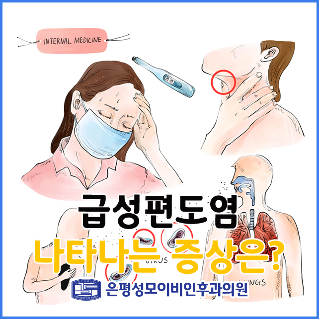 급성편도염 증상  좋구만