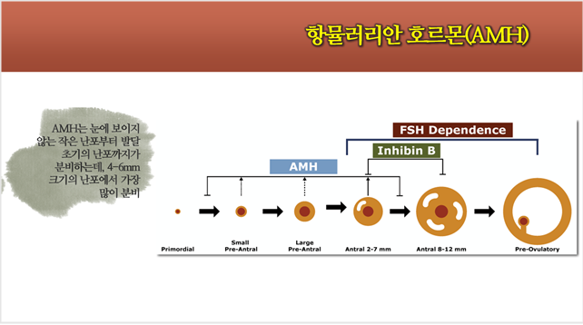 조기폐경과 무월경,AMH,OHSS. 정보