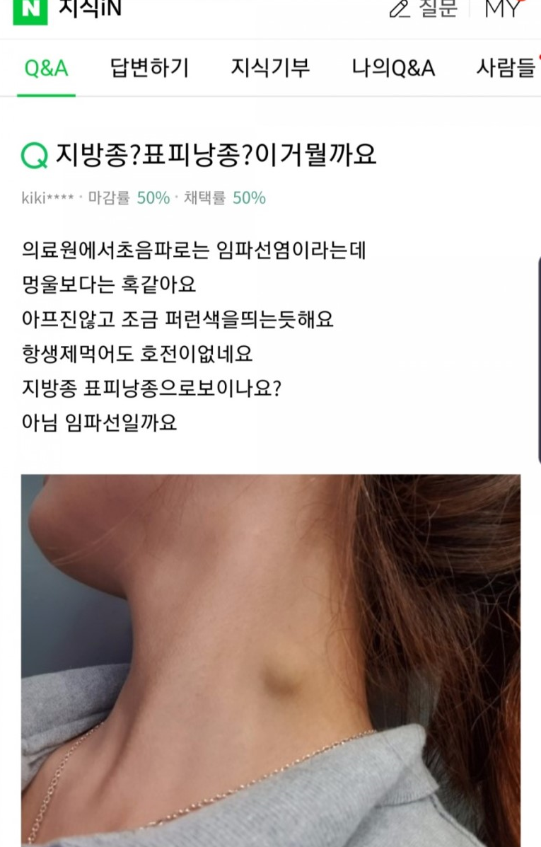 갑상선 초소음파 추적 검사 &  좋은정보