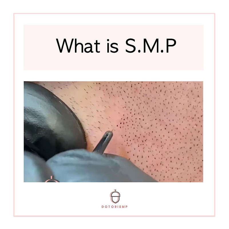What is SMP?(SMP의 정의)