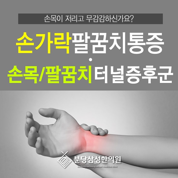 서현역한의원 손목터널증후군 손목 욱씬거림