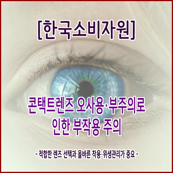 [한국소비자원] 콘택트렌즈 오사용·부주의로 인한 부작용 주의