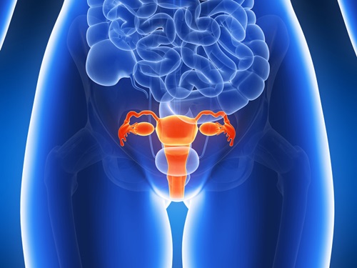 식이요법으로 자궁근종에 좋은 음식과 자궁근종 치료법 몇가지